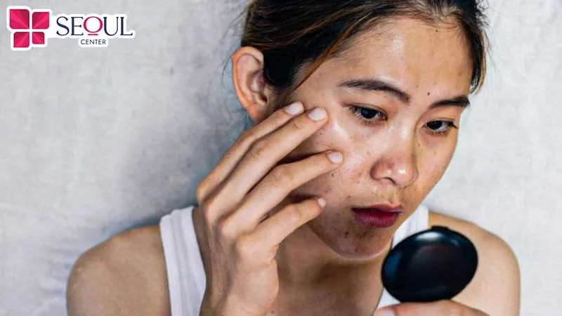 Da mặt sạm đen, kém sắc thường bắt nguồn từ những thói quen sinh hoạt không lành mạnh