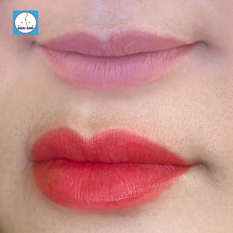 Thẩm mỹ viện Hoài Anh mang đến đôi môi bền đẹp và đôi mày sắc nét