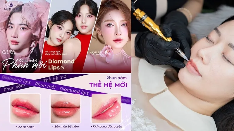Thẩm mỹ viện Quốc tế Linh Anh nơi được nhiều chị em quan tâm và tin tưởng