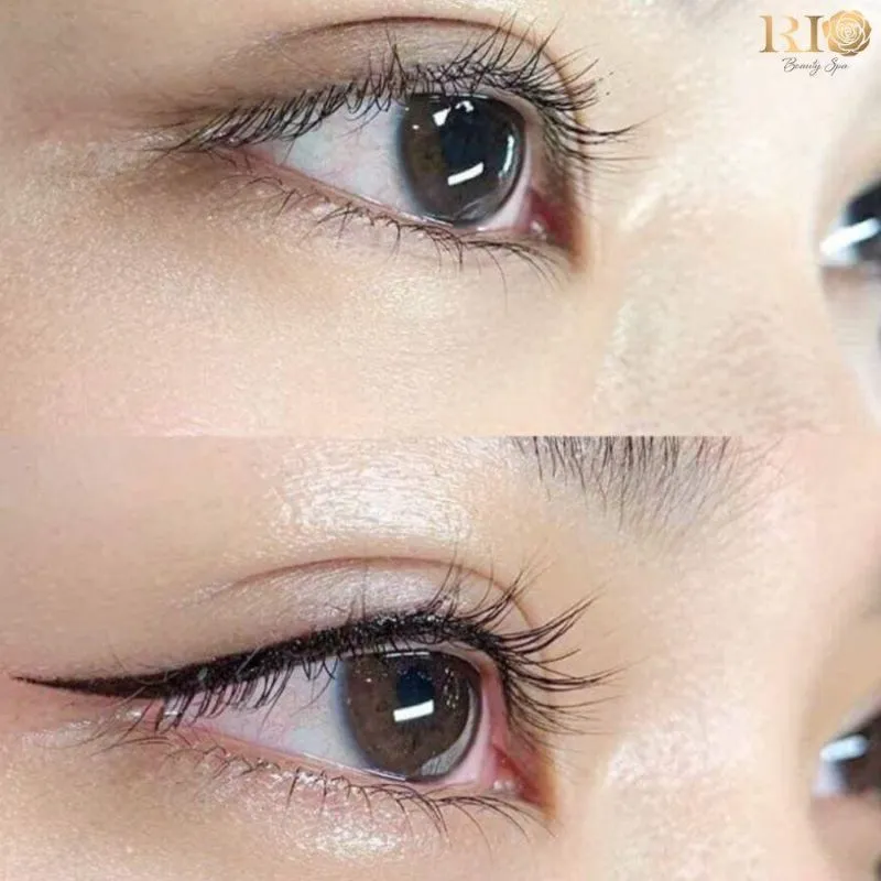 Rio Beauty Clinic là địa chỉ phun xăm Hà Nội đã luôn không ngừng nỗ lực đầu tư công nghệ máy móc hiện đại