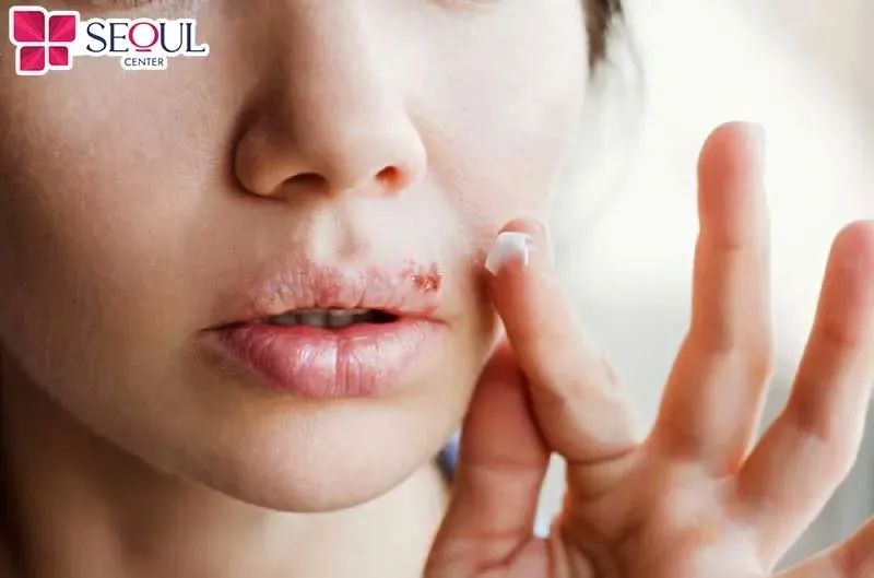 Phun môi collagen tại địa chỉ uy tín thì không gây hại cho sức khỏe