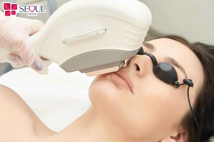 Triệt lông bằng các công nghệ hiện đại như laser sẽ giúp loại bỏ lông mặt tận gốc không nổi mụn