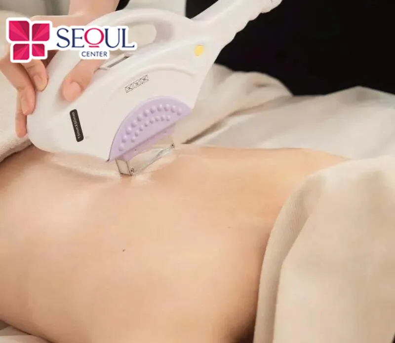 Triệt lông bằng công nghệ Elight - IPL thường cần nhiều buổi thực hiện hơn 