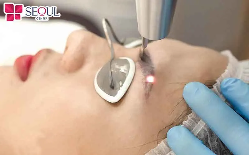 Giá xóa xăm chân mày bằng laser dao động từ 800.000 - 7.000.000 đồng