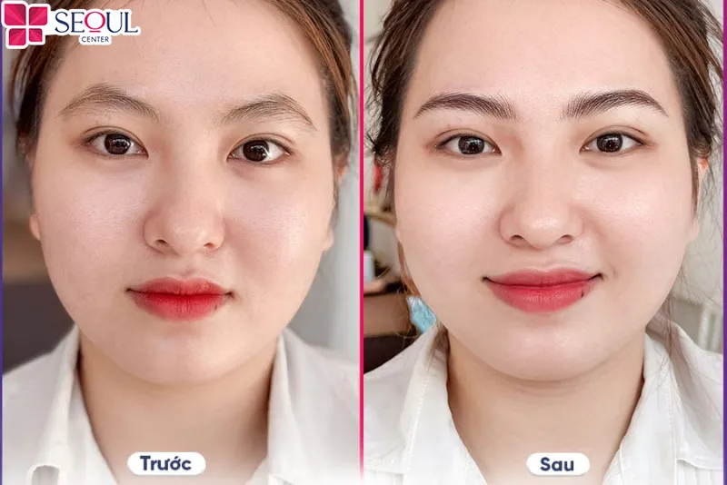 Chân mày sắc nét và hài hòa với gương mặt hơn khi điêu khắc chân mày 6D tại Seoul Center