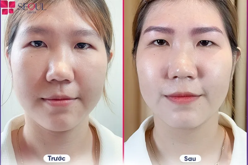 Khuôn mặt trở nên cân đối và cuốn hút hơn nhờ điêu khắc chân mày 6D