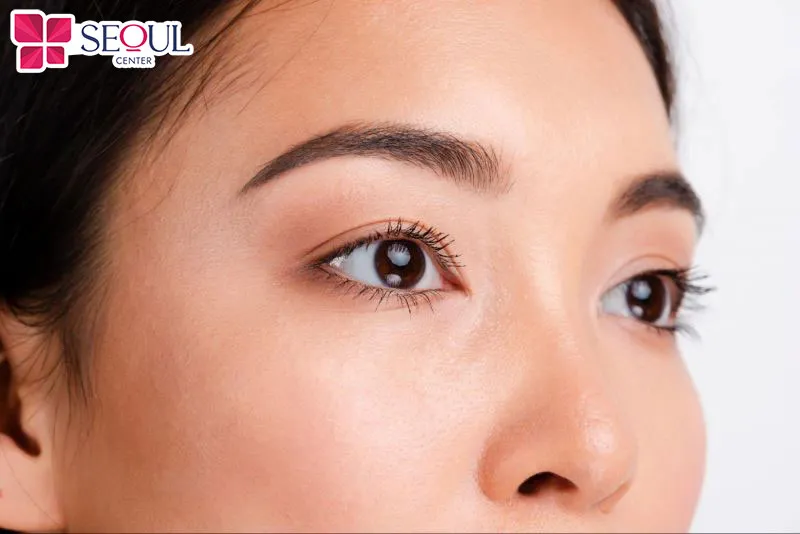 Mở rộng góc mắt ngoài là lựa chọn lý tưởng dành cho những ai có đôi mắt nhỏ, cụp đuôi hoặc thiếu cân đối