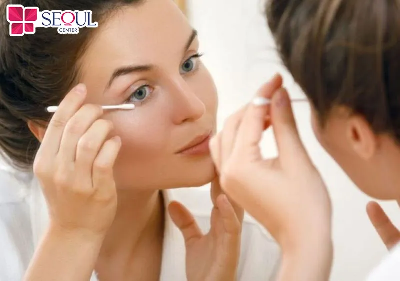 Dùng tăm bông thấm nước muối sinh lý để nhẹ nhàng làm sạch xung quanh vết mổ