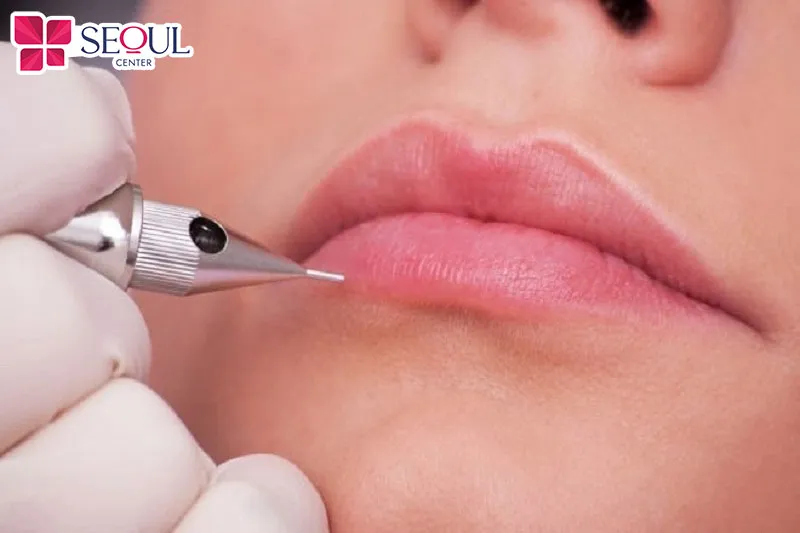 Phun môi Aqualips sử dụng đầu kim siêu nhỏ để hạn chế tình trạng đau rát