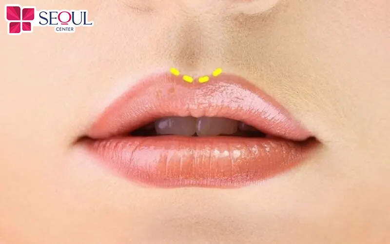 Phun môi giúp dáng môi hài hòa và mang lại vận khí tốt cho người sở hữu