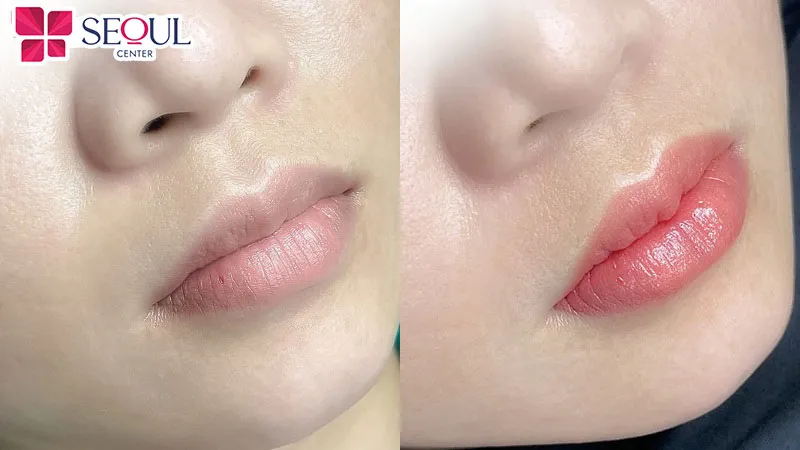 Một đôi môi với màu sắc tự nhiên và hài hòa với khuôn mặt