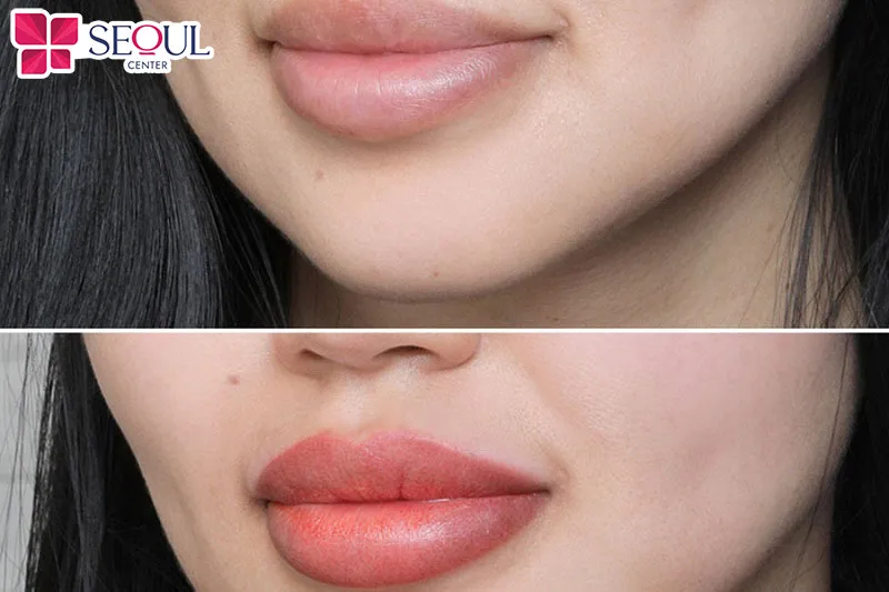 Quá trình bong tróc sẽ khác nhau tùy thuộc vào cơ địa mỗi người