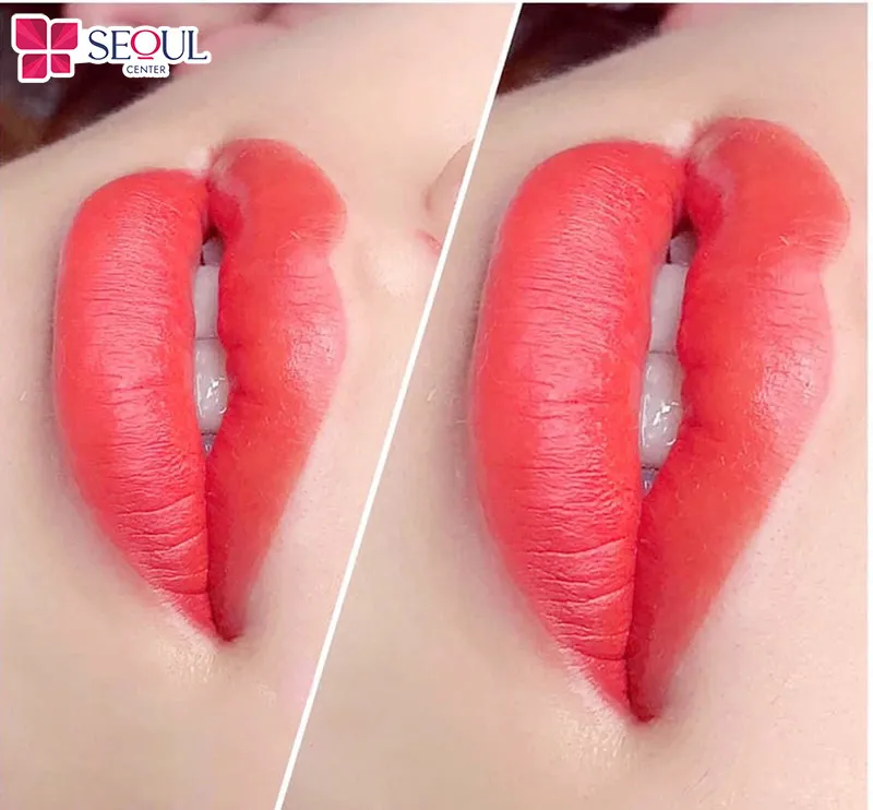 Việc lựa chọn phun hay xăm sẽ phụ thuộc vào nhu cầu mỗi người, nhưng phun môi vẫn là lựa chọn lý tưởng nhất dành cho mọi khách hàng