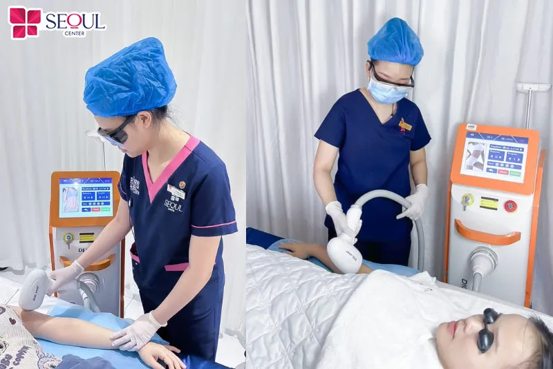 Triệt lông tại Thẩm mỹ viện Seoul Center Hà Nội vừa an toàn vừa hiệu quả sau vài buổi trị liệu