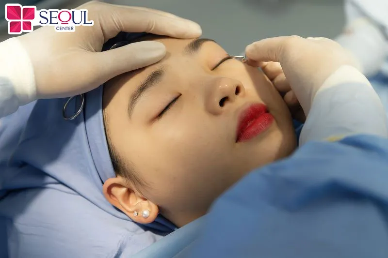 Tình trạng mí bị lật có thể do bác sĩ lấy quá nhiều da hoặc mỡ mí 