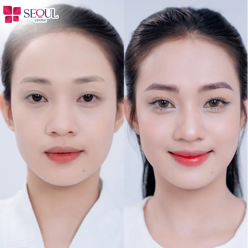 Diện mạo chị khách sáng rạng rỡ, trẻ trung và xinh xắn hơn sau khi thực hiện dịch vụ tại Seoul Center