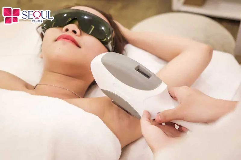 Sau khi triệt lông nách bằng công nghệ bạn không nên dùng lăn khử mùi 