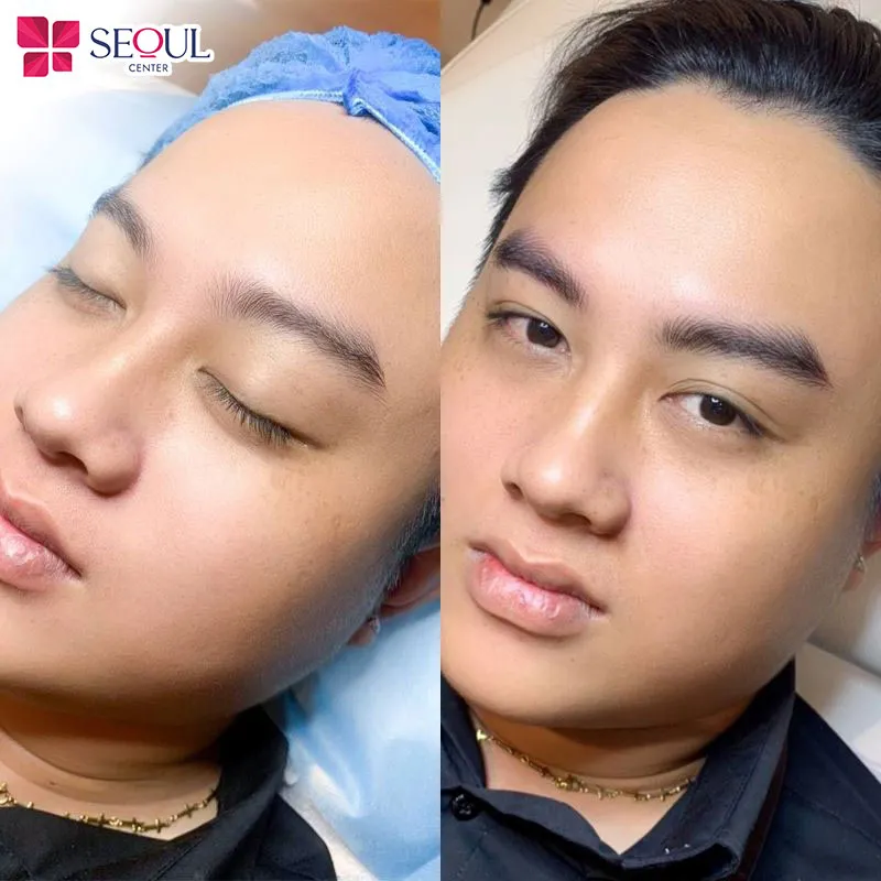 Khách hàng có thể trở lại làm việc ngay mà không cần nghỉ dưỡng quá lâu sau khi phun xăm chân nam giới