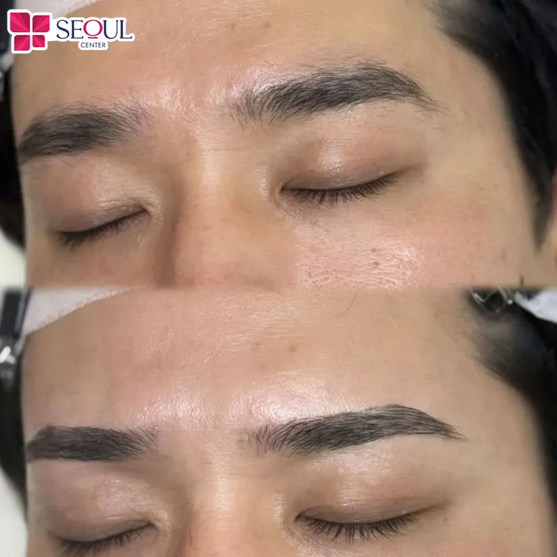 Sau khi điêu khắc chân mày xong, vùng da chân mày có thể hơi ửng đỏ nhẹ và nếu không chăm sóc kỹ có thể sẽ bị nhiễm trùng