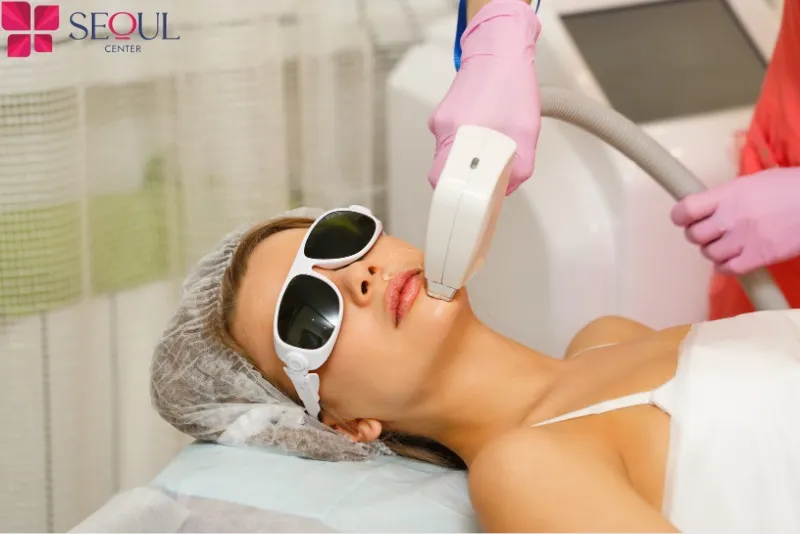 Triệt lông mặt phương pháp làm đẹp hiện đại được nhiều khách hàng tin chọn