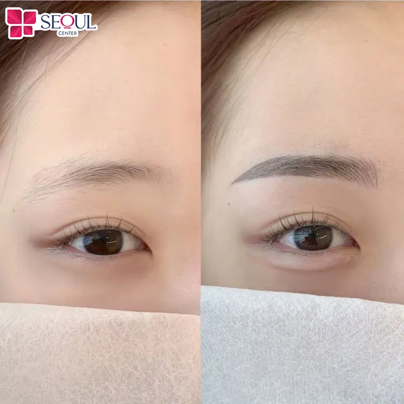 Khách hàng sau khi đến thực hiện phun mày tại thẩm mỹ viện Seoul Center