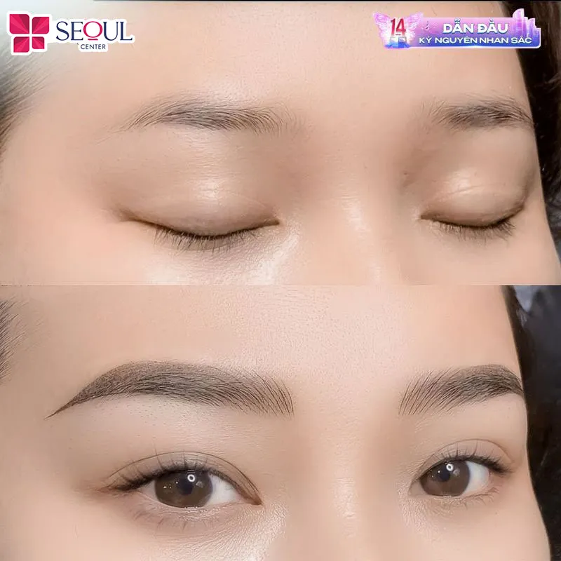 Dáng mày trước và sau khi khách hàng đến Thẩm mỹ viện Seoul Center thực hiện phun chân mày hiệu ứng bút chì