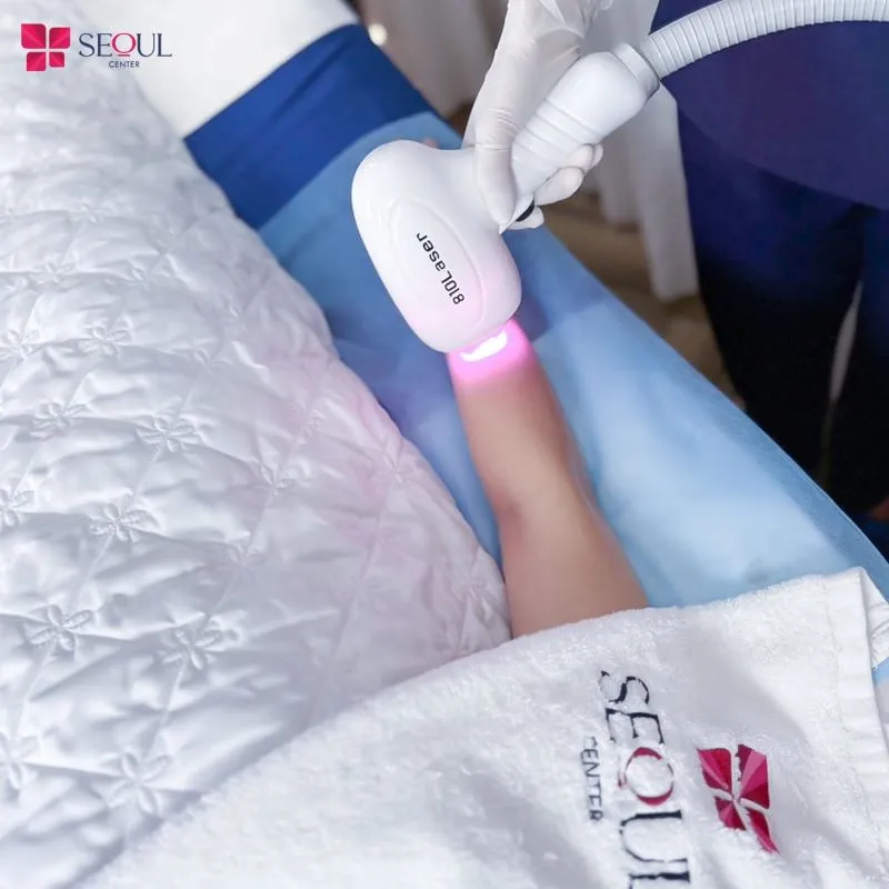 Khách hàng trải nghiệm triệt lông cánh tay tại thẩm mỹ viện Seoul Center bằng công nghệ triệt lông hiện đại