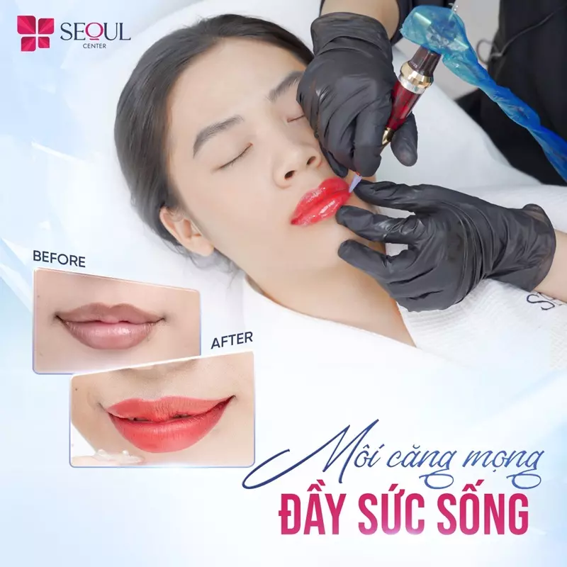 Màu môi của khách hàng trông tràn đầy sức sống, tươi trẻ sau khi thực hiện phun xăm môi tại Thẩm mỹ viện Seoul Center