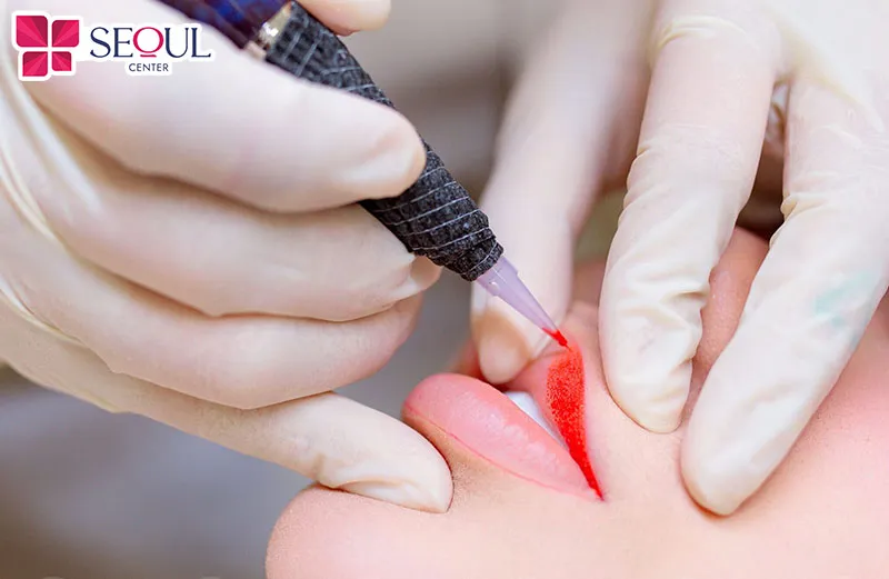 Sử dụng đầu kim chưa được vô trùng kỹ hoặc đã qua sử dụng là nguyên nhân chính gây nhiễm trùng sau phun