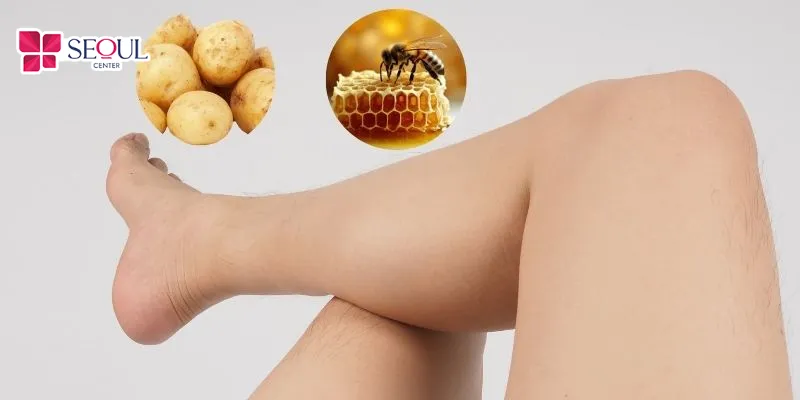 Khoai tây và mật ong khi kết hợp sẽ tạo thành hỗn hợp ức chế lông mọc khá tốt