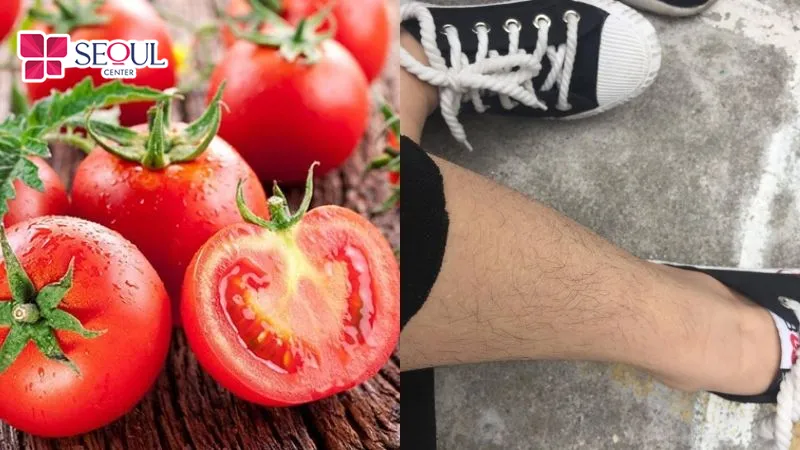 Cà chua có thể làm da chân sáng, lông chân giảm mọc hơn