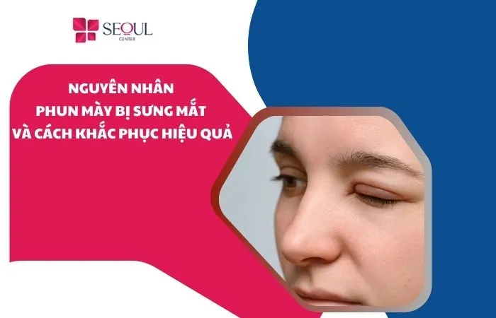 Nguyên nhân phun mày bị sưng mắt và cách khắc phục hiệu quả