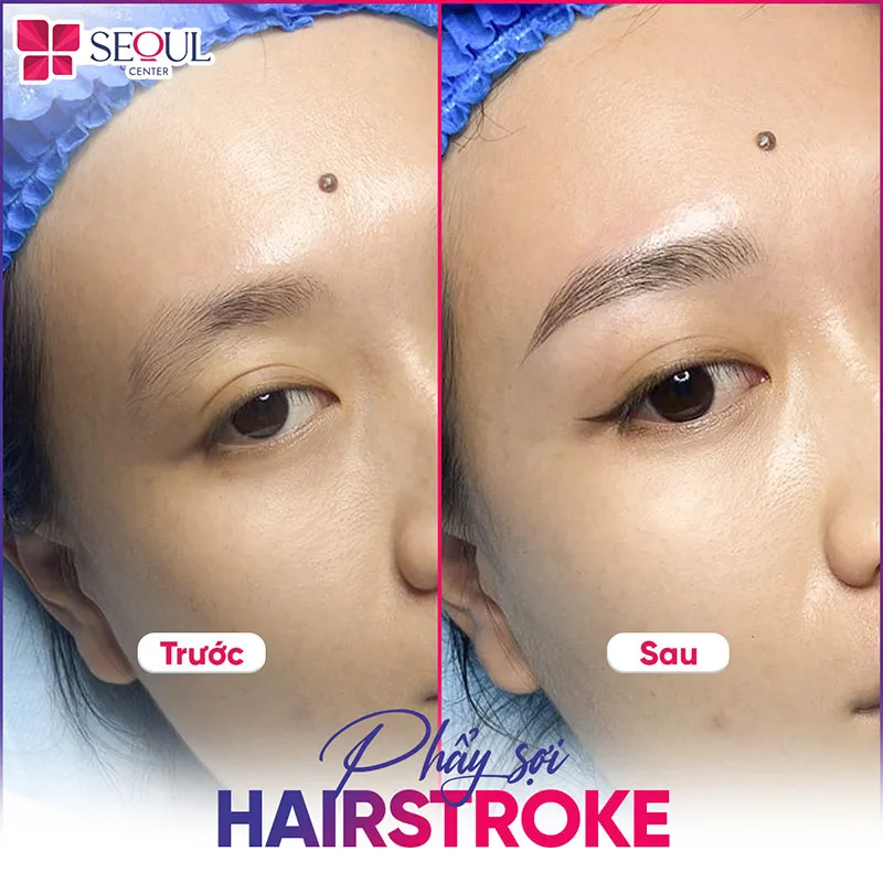 Hình ảnh trước sau của khách hàng khi phun màu nâu cafe kỹ thuật hairstroke tại Seoul Center