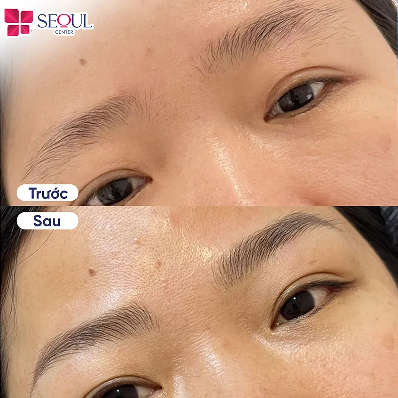 Phun mày nâu cafe kỹ thuật điêu khắc tại Seoul Center mang lại dáng mày đẹp tự nhiên như thật cho khách hàng