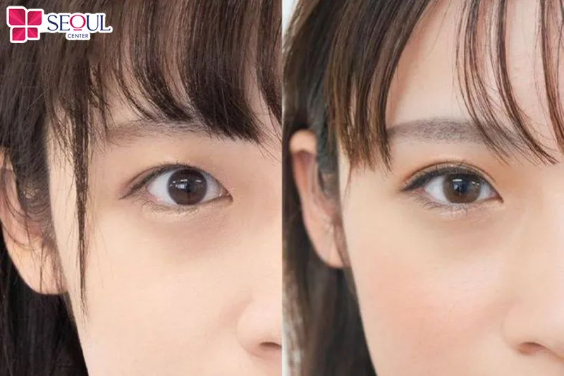 Có khá nhiều yếu tố ảnh hưởng đến giá phun mí eyeliner