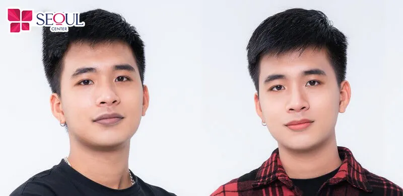 Môi sau phun trông tươi tắn và toát lên vẻ cuốn hút