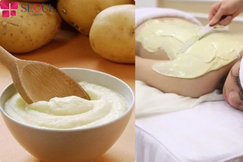 Khoai tây kết hợp với sữa tươi giúp da sáng đều màu, căng mịn và rạng rỡ hơn