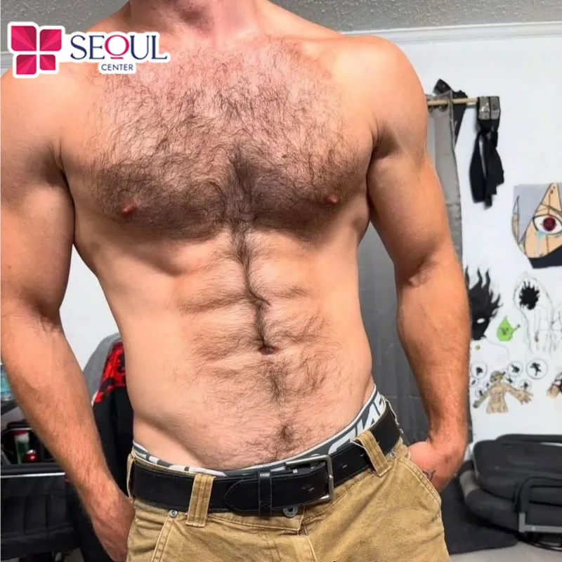 Những người có lông mọc rậm rạp, dày cần thực hiện nhiều buổi triệt lông ngực để đạt được kết quả tốt