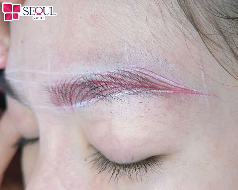 Khách hàng sẽ được ủ tê đầy đủ trước khi thực hiện, nhưng đối với những ai có cơ địa nhạy cảm vẫn có thể cảm thấy đau rát