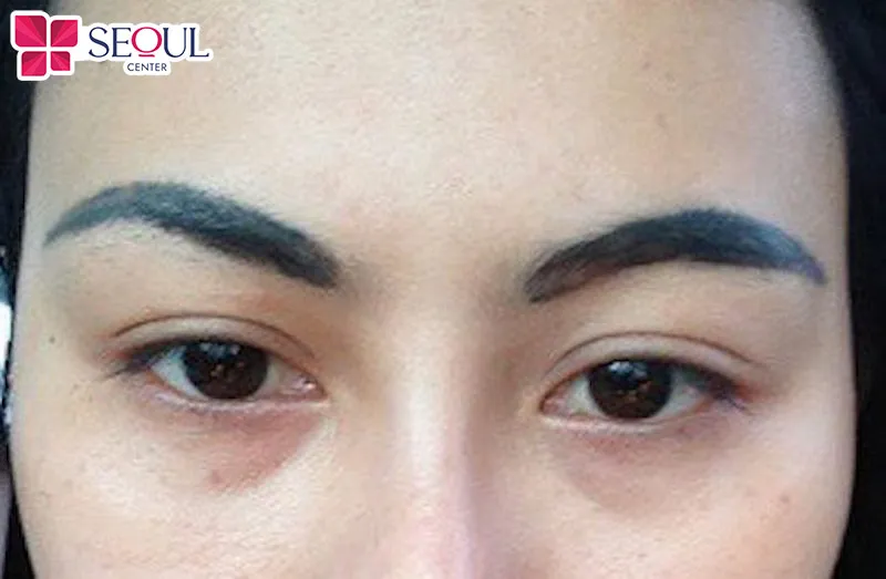 Nhược điểm của điêu khắc chân mày là nếu thực hiện tại cơ sở kém uy tín, mực không chất lượng thì dáng mày có thể trổ xanh trổ đỏ