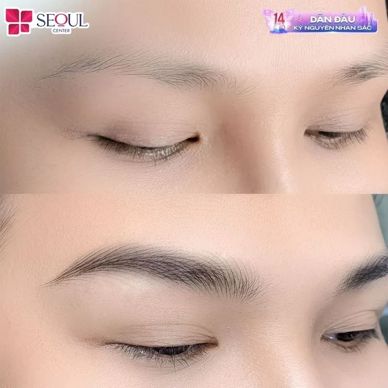 Khách hàng sau khi đến thực hiện phun xăm mày tại Thẩm mỹ viện Seoul Center