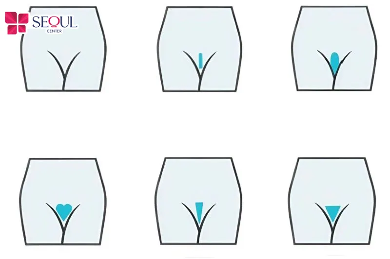 Các kiểu tạo hình lông vùng kín đẹp được nhiều chị em ưa chuộng