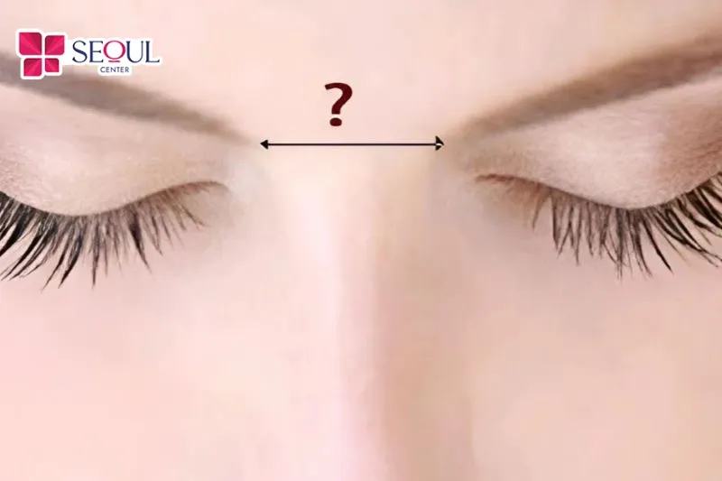 Lông mày cách xa mắt nếu khoảng cách đầu hai mày rộng, lông mày cao so với sống mũi hơn bình thường