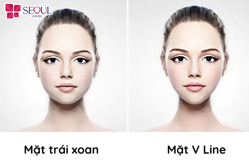 Mặt trái xoan thường có cấu trúc xương cân đối, chiều dài khuôn mặt sẽ nhỉnh hơn so với chiều ngang và được bo tròn nhẹ