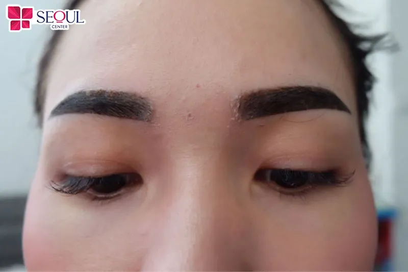 Mực xăm kém chất lượng làm cho chân mày bị đậm, màu không đẹp