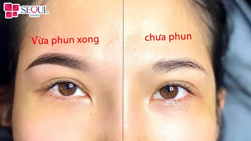 Cần chăm sóc kỹ lưỡng theo lời khuyên của bác sĩ để chân mày lên màu chuẩn đẹp