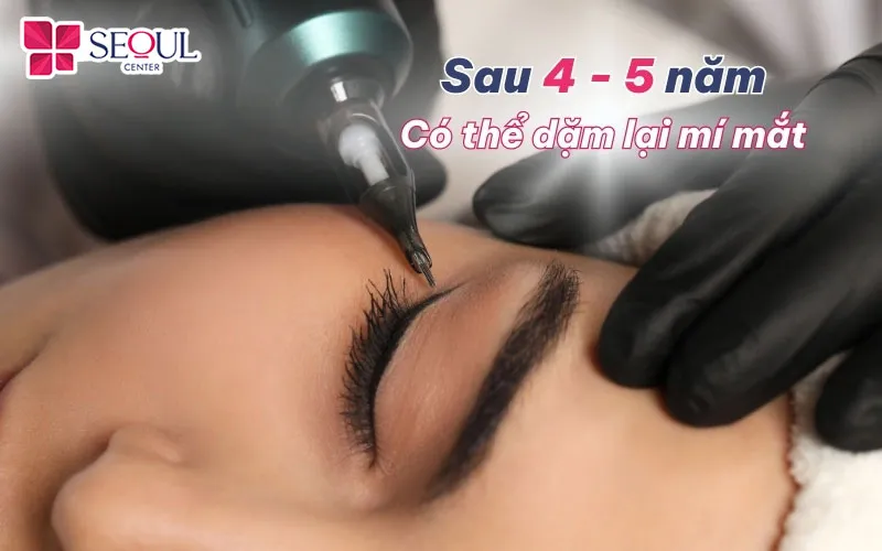 Nếu màu mí bị phai dần sau 4 - 5 năm, bạn có thể dặm lại để đuôi mắt trở nên rõ nét hơn