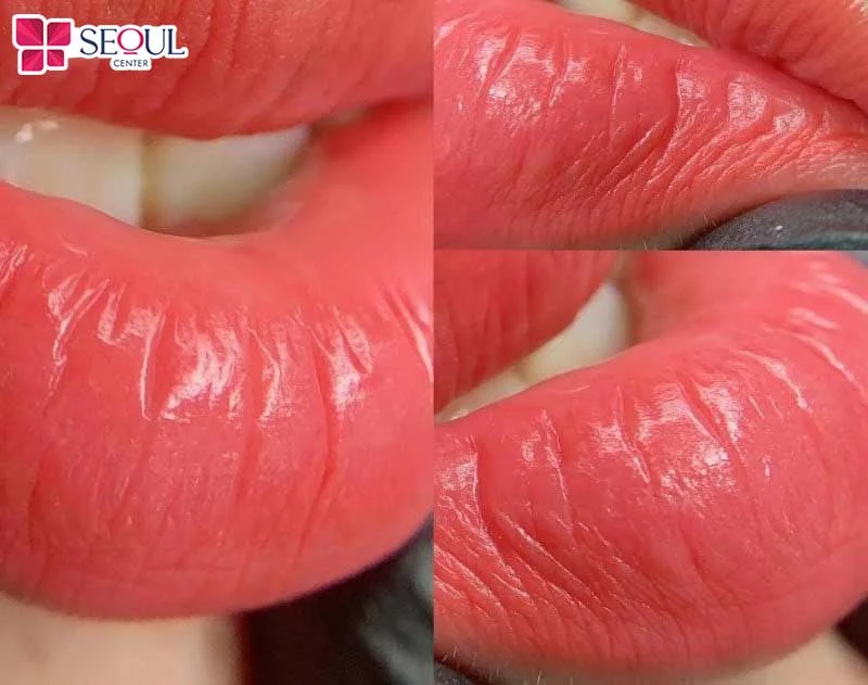 Sau phun môi một thời gian ngắn, khách hàng sở hữu bờ môi quyến rũ, đầy sức hút