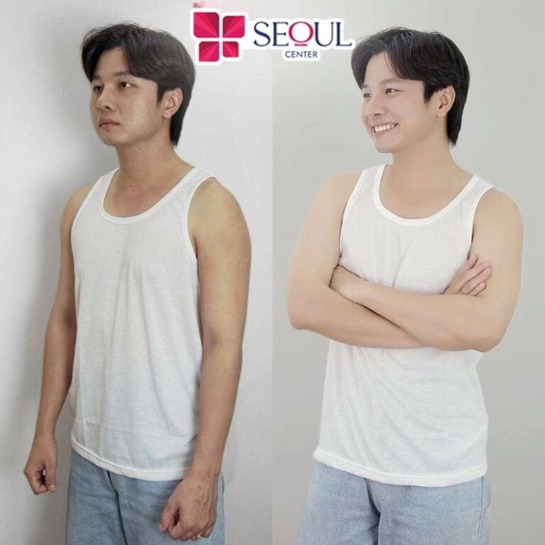 Seoul Center là địa chỉ tắm trắng nam an toàn và mang lại hiệu quả cao