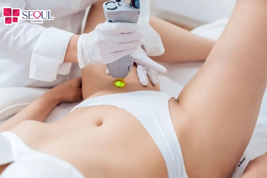 Triệt lông bikini bằng công nghệ cao giúp loại bỏ lông tận gốc nang lông, ngăn chặn lông mọc lại khá tốt, đặc biệt không gây thâm